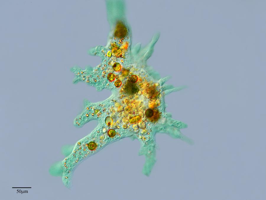 Repurposed drug can save patients infected with rare brain-eating amoeba