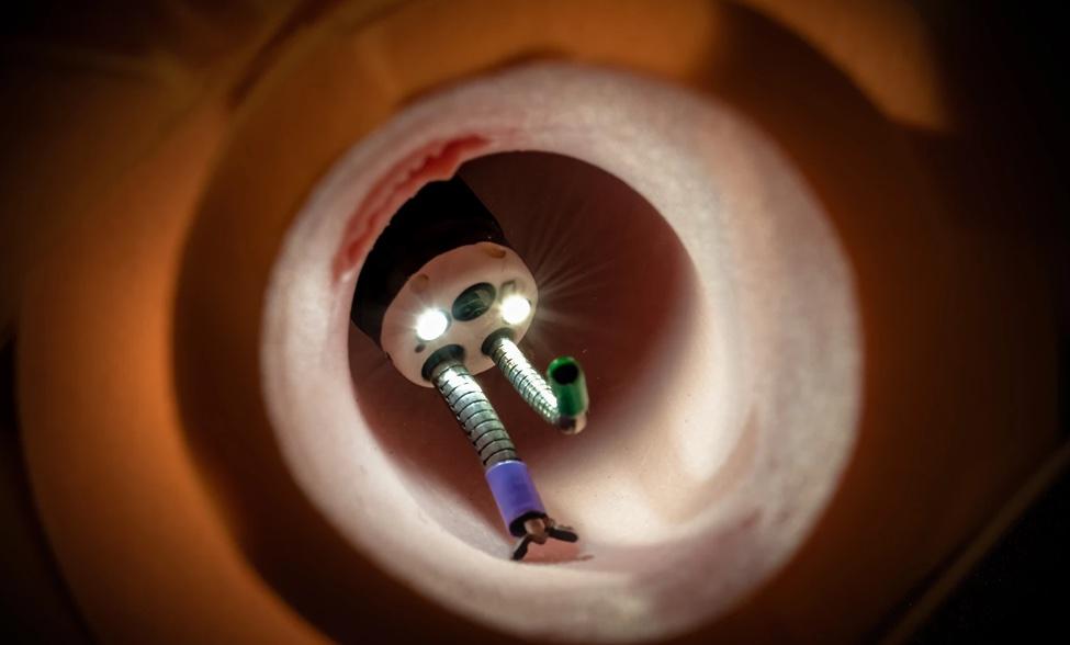 Cutting-Edge Endoscopy Device Receives FDA Breakthrough Device Designation, Paving Way for Improved GI Tract Diagnosis and Treatment